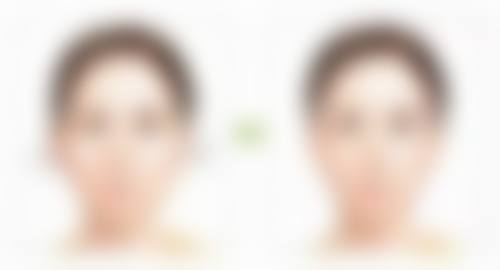 二、眼袋和眼睑的区别