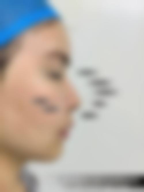 四、深圳福雅医学美容门诊部特色项目