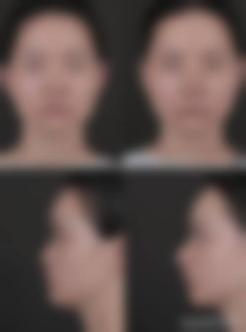 四、深圳博研医疗美容门诊部特色项目