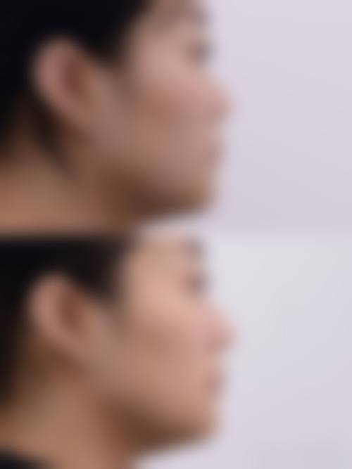 六、深圳博研医疗美容门诊部价格表