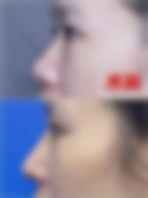 八、余姚市人民医院医疗美容科预约方式