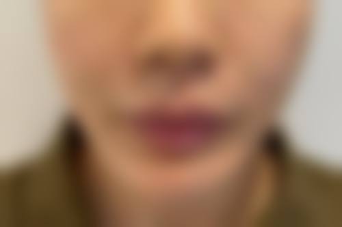 八、广西秦颜医疗美容门诊真实的患者评价