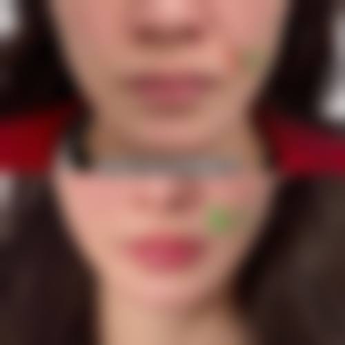 七、濮阳欣艺医疗美容诊所预约方式