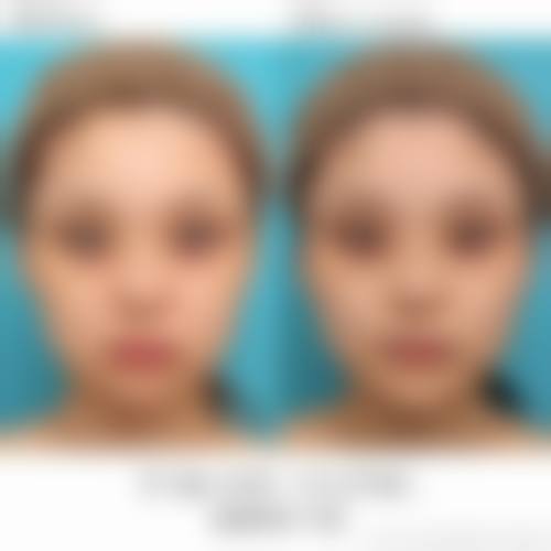 五、濮阳欣艺医疗美容诊所价格表