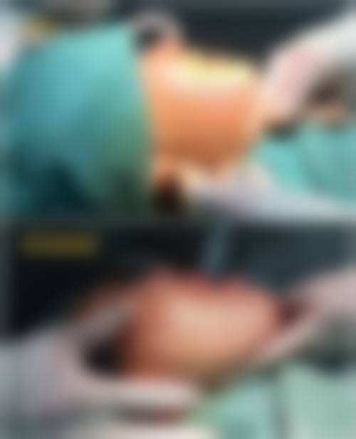 六、安阳姣点医疗美容医院价格表