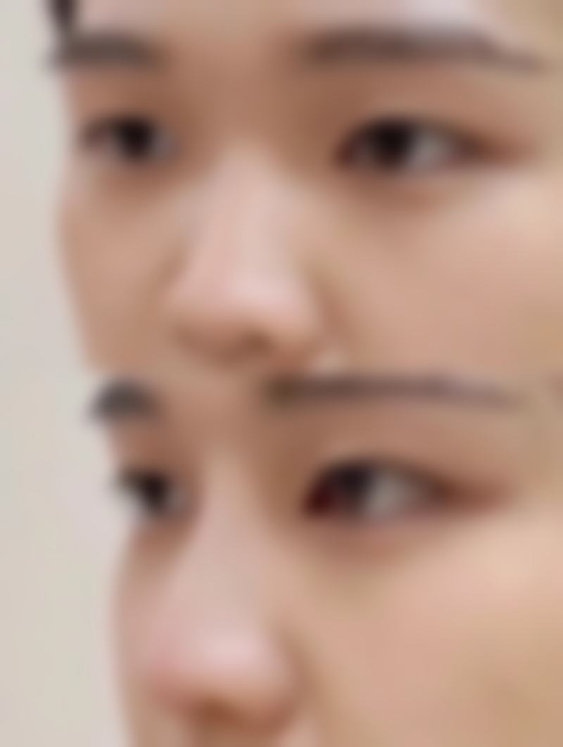 二、余姚市人民医院医疗美容科怎么样？