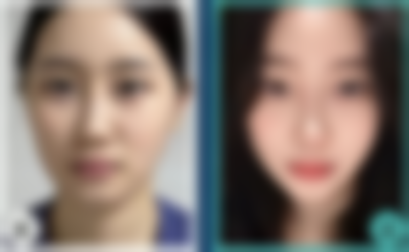 眼袋和眼睑是一个部位吗？