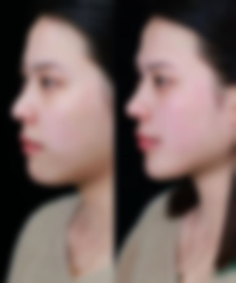 六、深圳福雅医学美容门诊部地址及交通