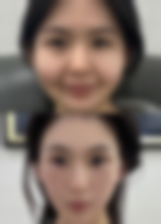 三、青岛海伦美容医院植发科诊疗项目有哪些？