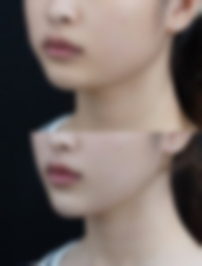 九、广州伊丽莎白医疗美容医院真实的患者评价