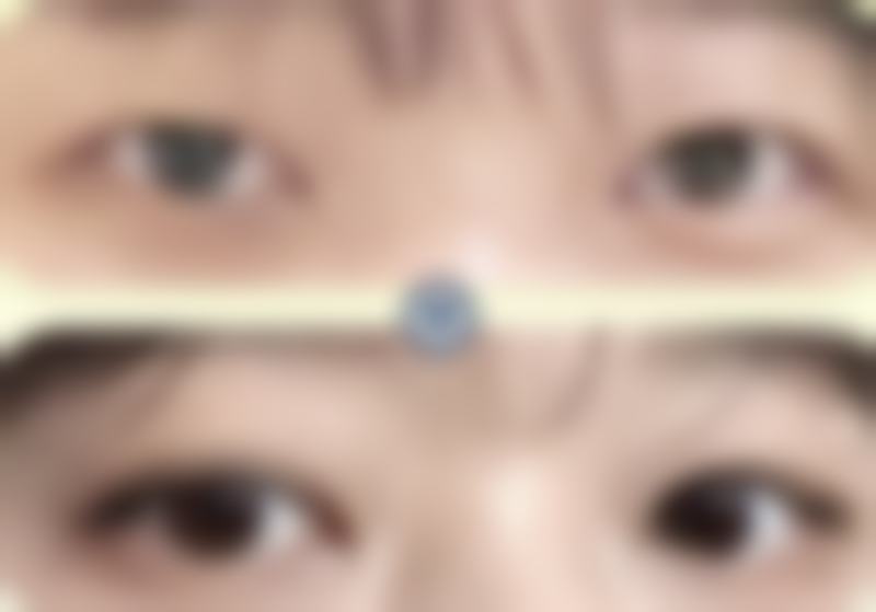 三、余姚市人民医院医疗美容科诊疗项目有哪些？