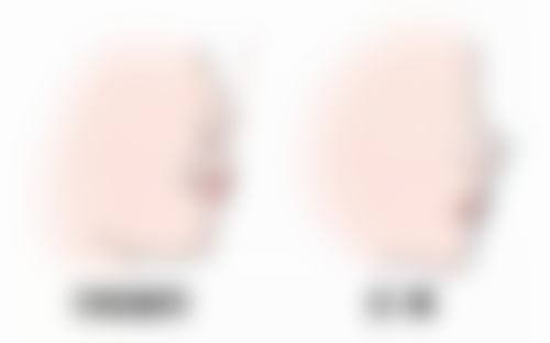 二、不同类型眼霜推荐