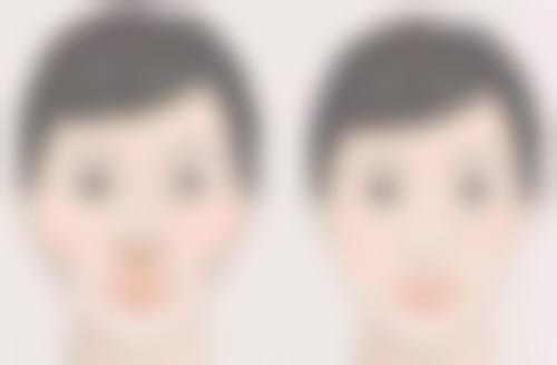 四、留疤风险与饮食的关系