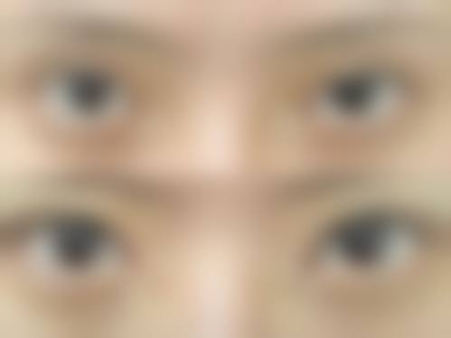 四、广州星火医院整形美容科特色项目