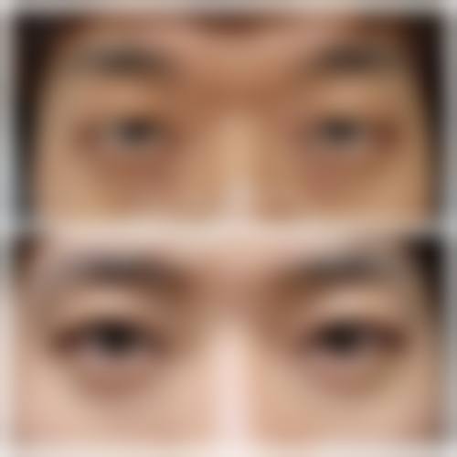 八、广州美诗沁整形医疗美容门诊部真实的患者评价