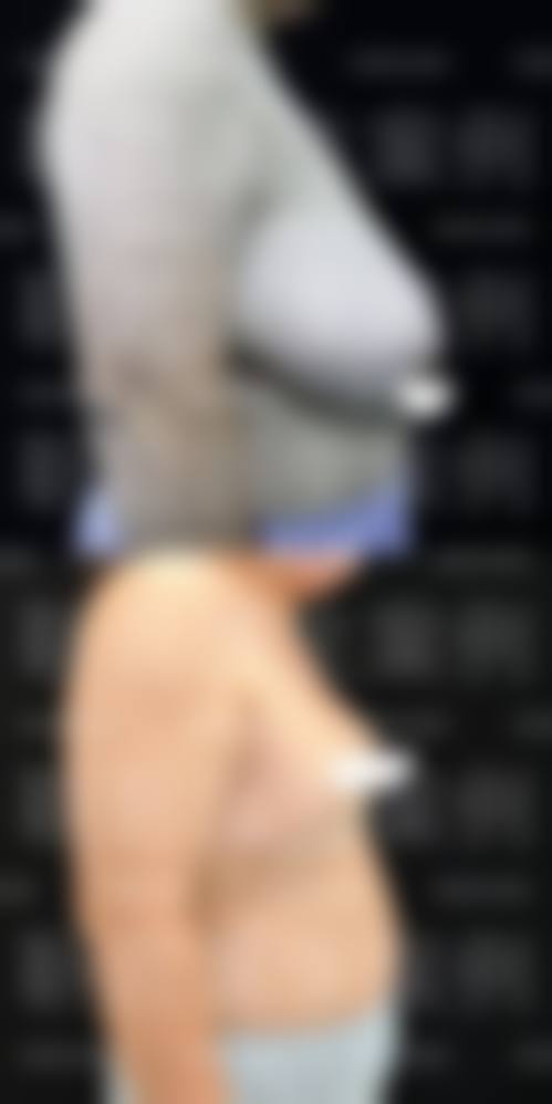 三、温州龙湾伯思立医院整形科诊疗项目有哪些？