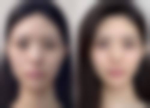 三、深圳鸿瑞医疗美容门诊部诊疗项目有哪些？