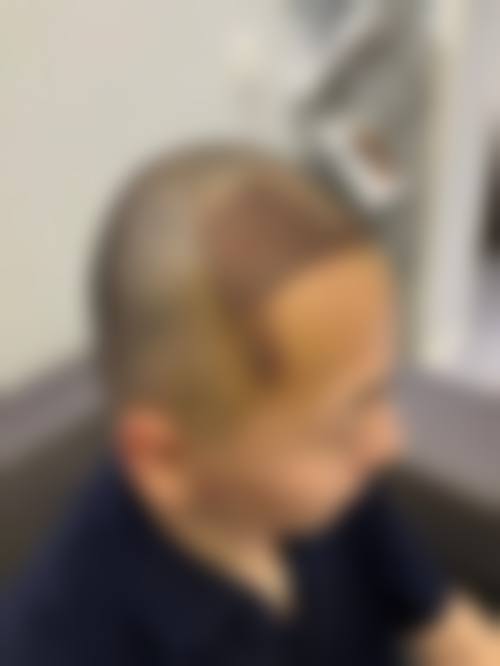 五、贵阳盛初植发价格表