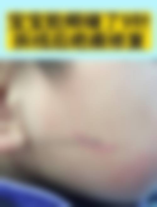 六、杨成真实的患者评价