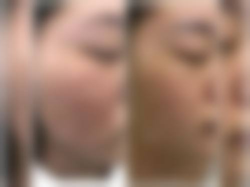 四、北京爱悦丽格医疗美容门诊部特色项目