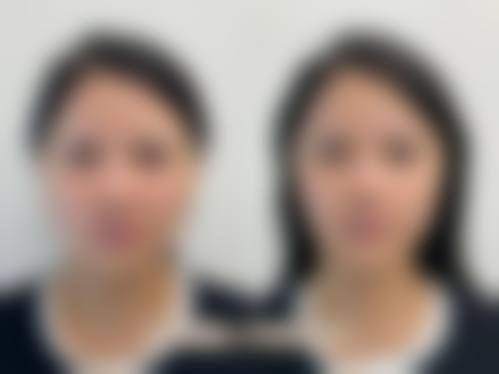 五、郑州宝丽医疗美容门诊部价格表