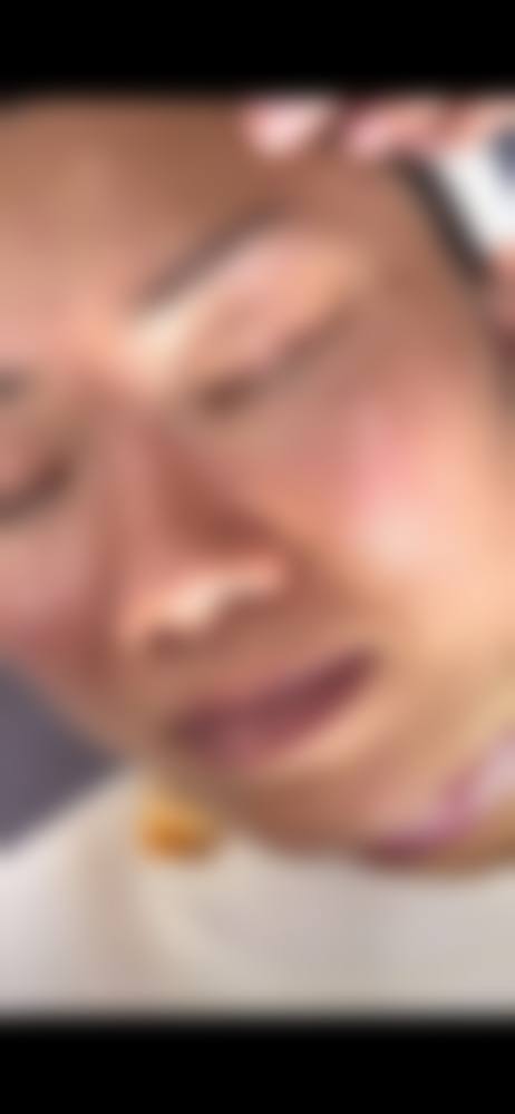 三、贵阳联成益美植发科诊疗项目有哪些？