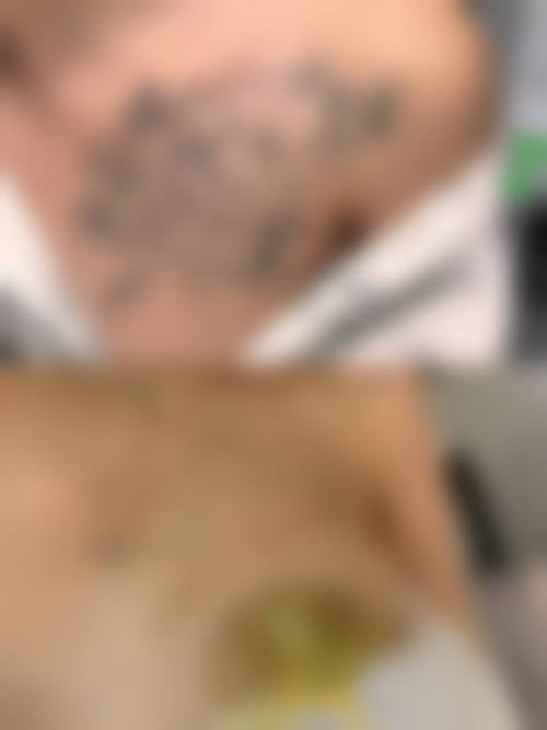 四、长治天成医疗美容诊所特色项目