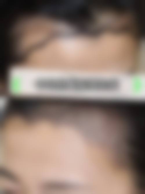 八、北京中加科洋医疗美容医院真实的患者评价