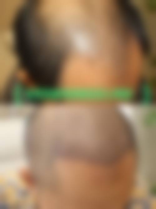 二、贵阳盛初植发怎么样？