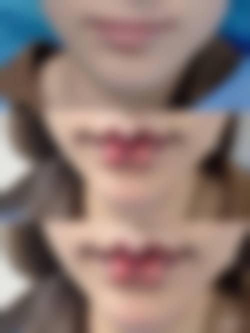 九、上海颜范医美真实的患者评价