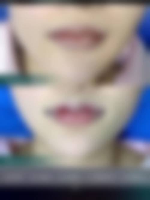 六、上海颜范医美价格表