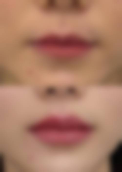 八、南京女绅士整形医疗美容真实的患者评价