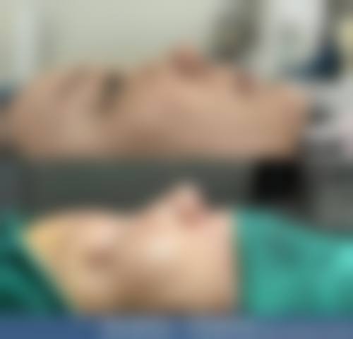 八、沈阳星美整形医院真实的患者评价