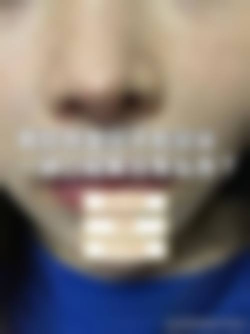 七、贵阳盛初植发预约方式