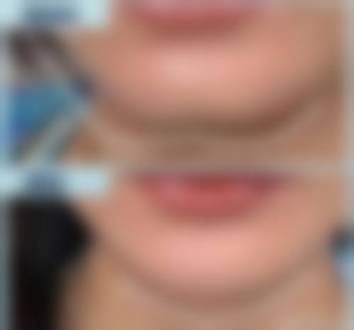 五、湘南美容 长崎价格表