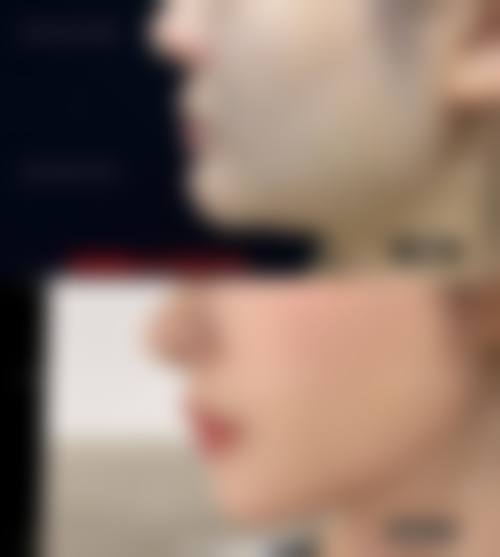 二、贵阳联成益美植发科怎么样？