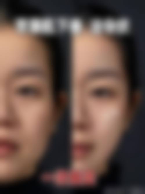 九、北京爱悦丽格医疗美容门诊部真实的患者评价