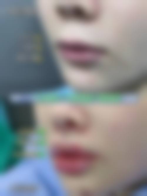 六、北京爱悦丽格医疗美容门诊部价格表