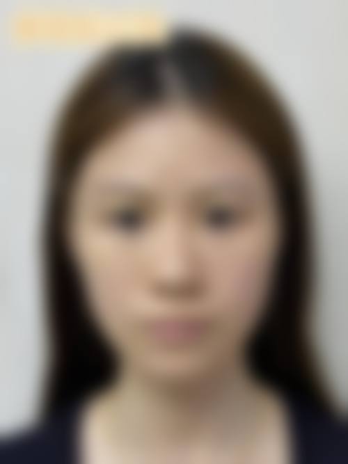 八、淮北相山时光医疗美容门诊部真实的患者评价