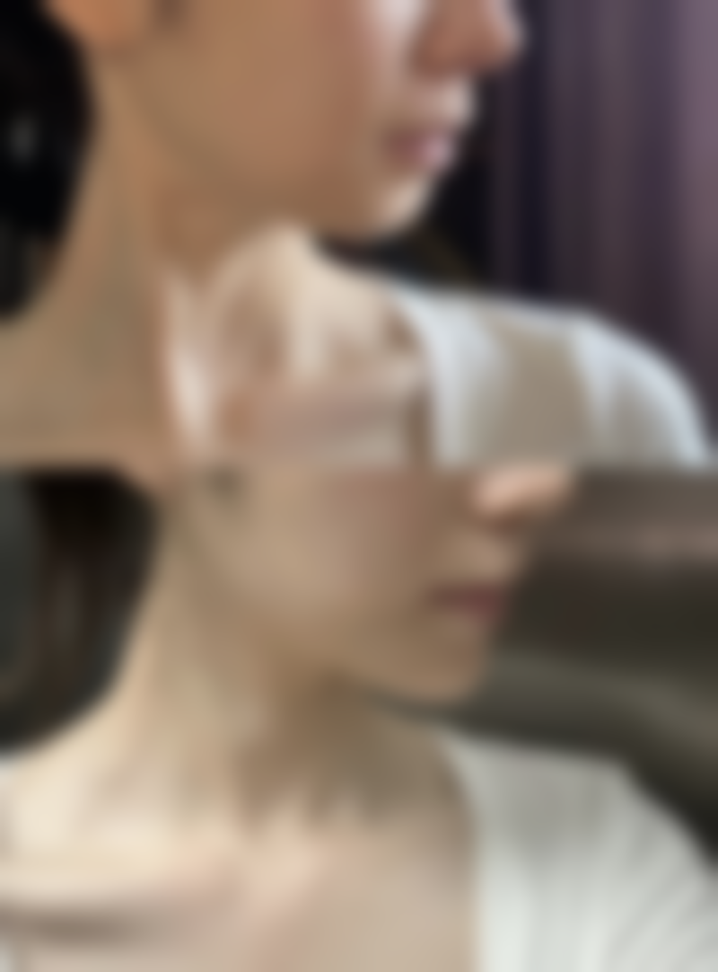 眼袋严重用什么眼霜效果好？多类型眼霜推荐及日常护理建议助你改善眼袋问题 