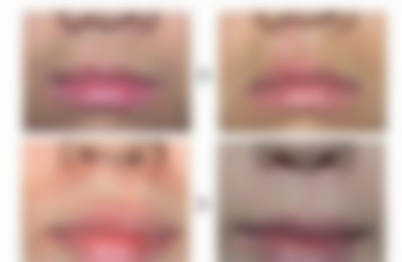 三、重庆启新医疗美容门诊部诊疗项目有哪些？