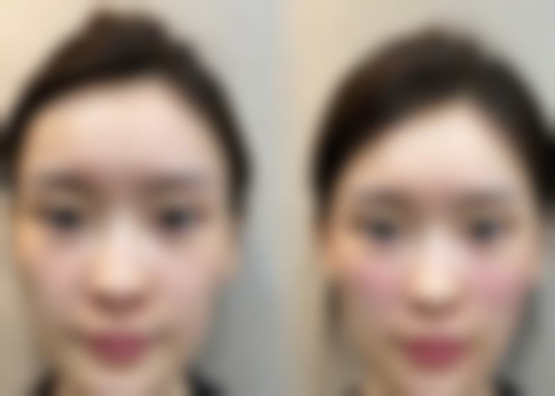 八、长治天成医疗美容诊所预约方式