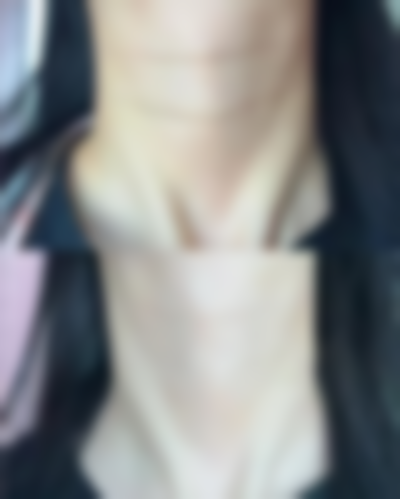 五、药膏的局限性及其他治疗建议