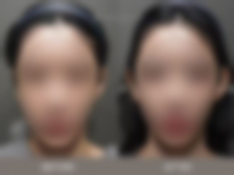 三、清洁与保湿消肿法