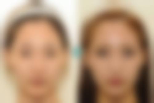 四、中山伊美神医疗美容整形医院特色项目