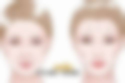 一、突眼做双眼皮手术的综合评估要点