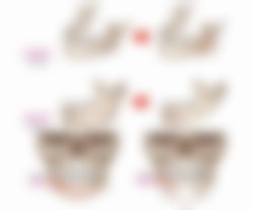 四、怎样去眼袋又快又好的小窍门之药物治疗