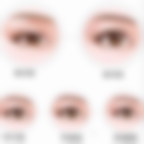 七、关于超体隆鼻的常见疑问解答