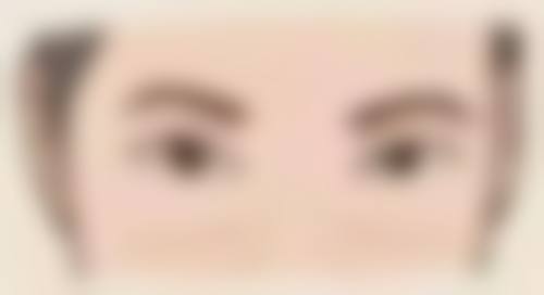 三、英捷尔法勒隆胸取出修复时间的影响因素