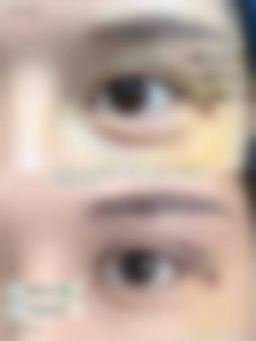 四、内蒙古紫洁医疗美容医院特色项目